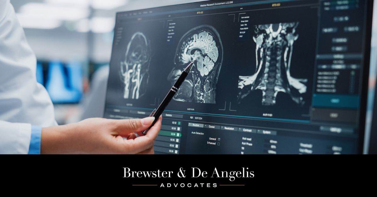 Catastrophic Injuries